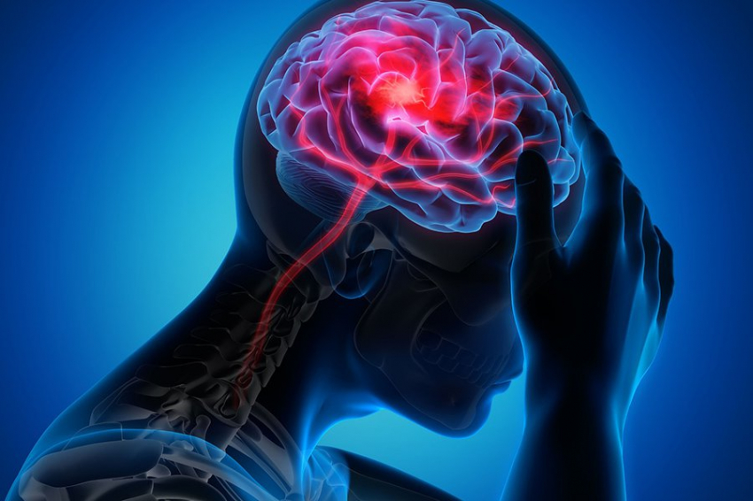 Изменения сосудов головного мозга прогнозируют когнитивные нарушения