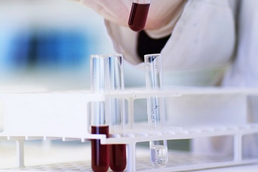 Врач-трансфузиолог назвал самую редкую группу крови