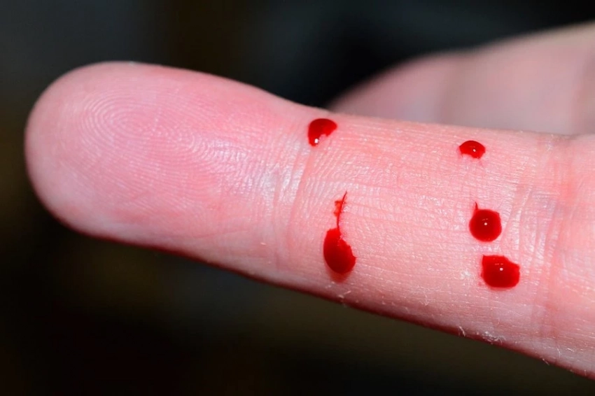 Пензенские ученые создали ИИ-приложение для мгновенного выявления болезней