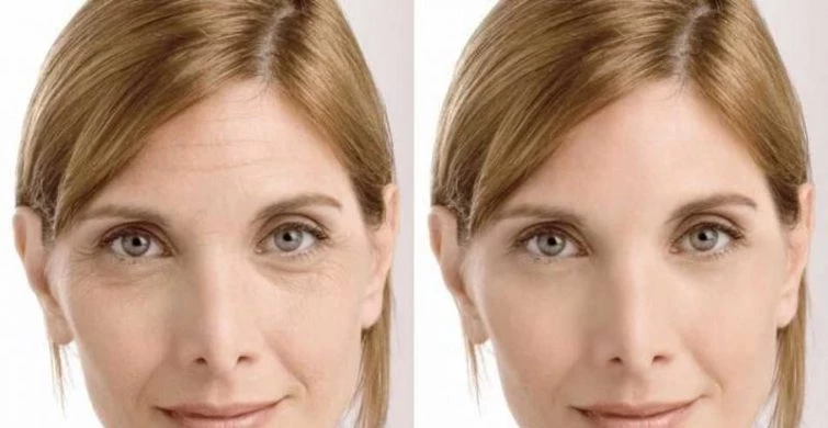 Идеалы красоты и их влияние на нас: от комплексов до саморазрушения